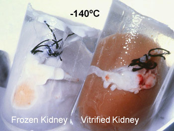 frozen kidney vs. vitrified kidney