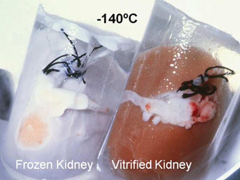 Cryonics Suspension Vats